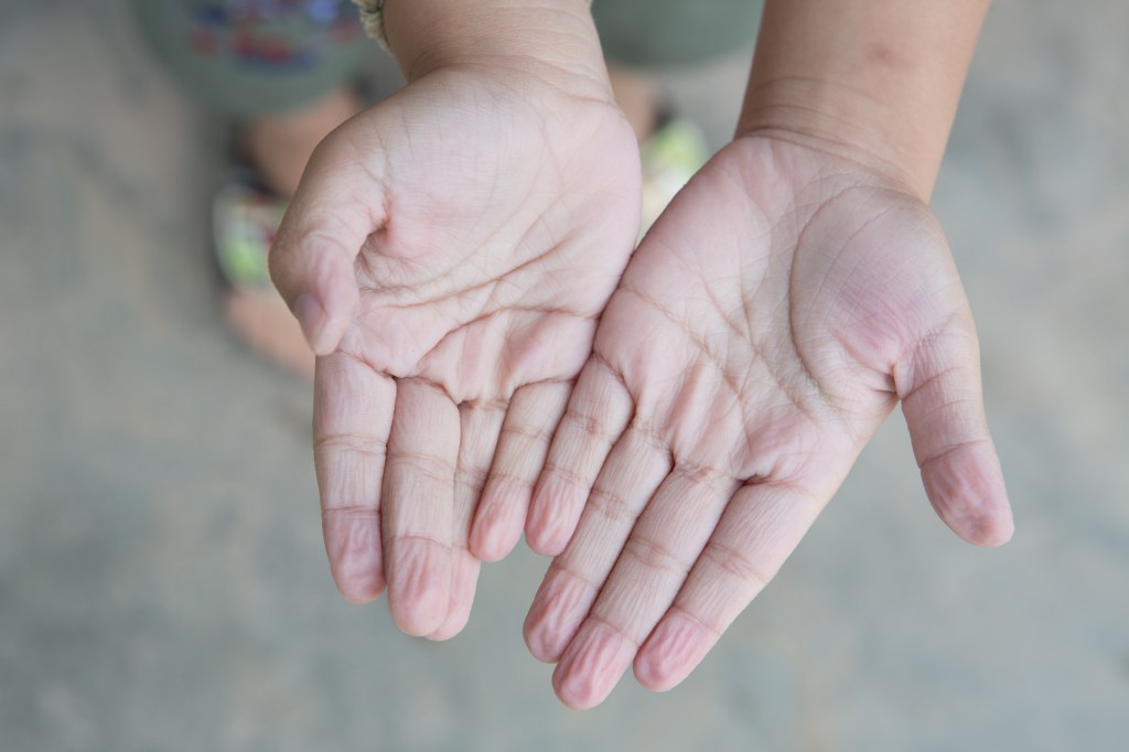 mecanismos-defesa-corpo-4 7 reações do corpo que são mecanismos de defesa e você nem sabia